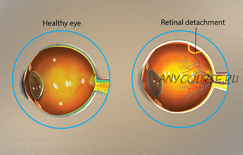 [Sigh Energy] Заживление и регенерация сетчатки. Retinal Healing and Regeneration Powerful Plus +11x(Extra