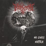 NEPHRECTOMY - No Lives Matter